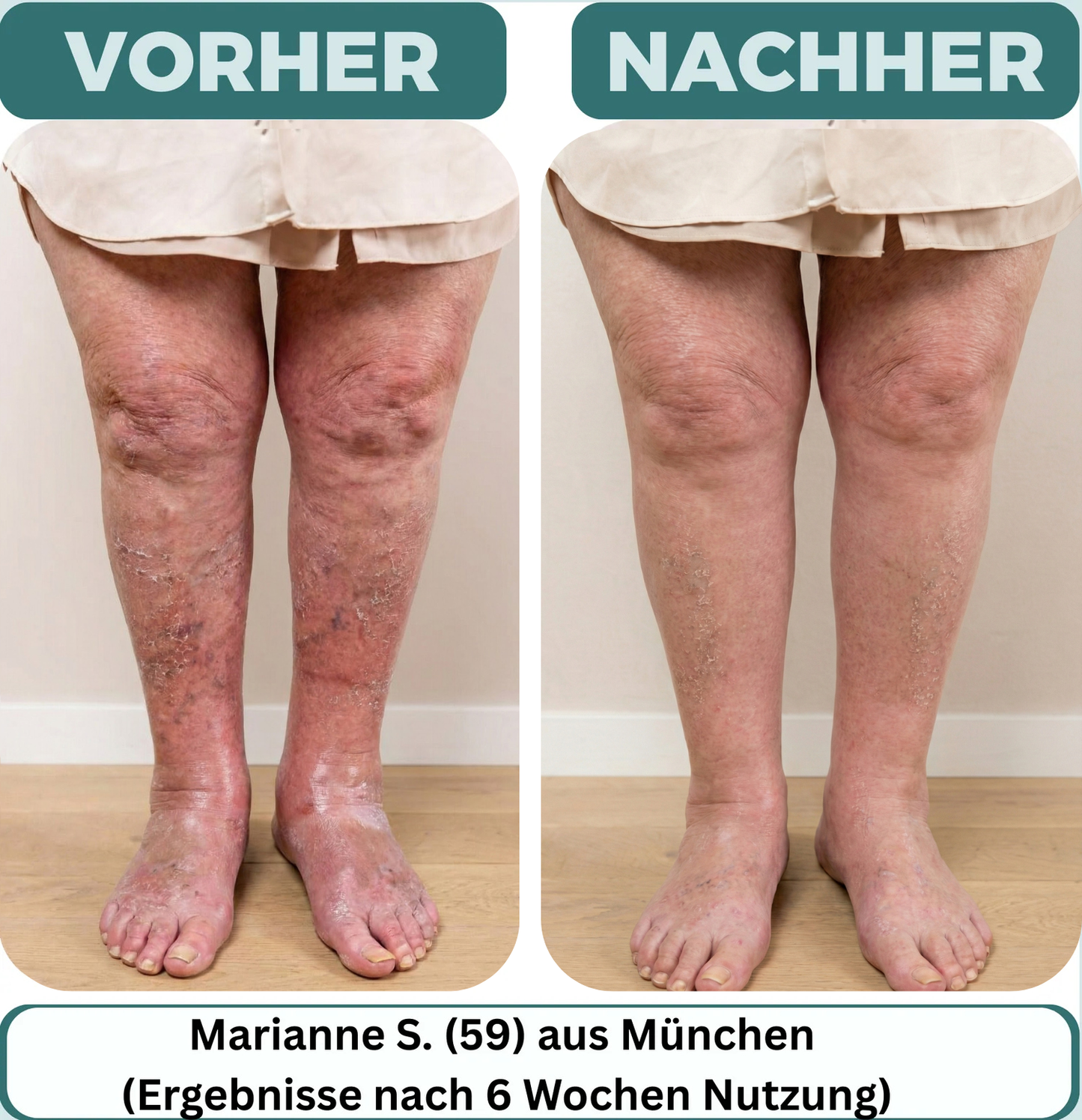 Orthoflex™ Magnet-Akupressur-Einlegesohlen