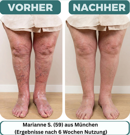 Orthoflex™ Magnet-Akupressur-Einlegesohlen